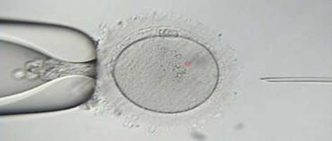 Read more about the article What is ICSI (Intra Cytoplasmic Sperm Injection)